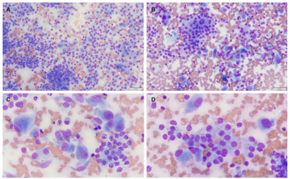 Perianal mass cytology figure