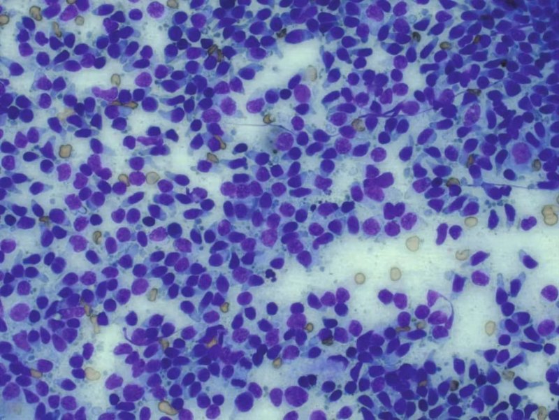 Cytology field of a canine round cell tumour with numerous discrete purple-stained cells